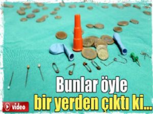 Bunlar çocukların yemek ve soluk borusundan çıktı