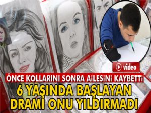 6 yaşında başlayan dramı onu yıldırmadı
