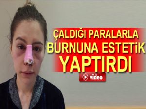 Çaldığı paralarla burnuna estetik yaptırdı
