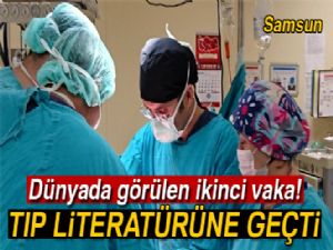 Dünyada ikinci kez rastlanan vaka doktorları bile şaşırttı