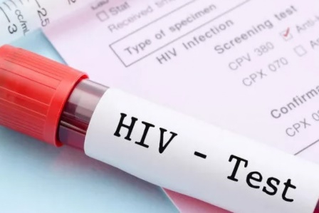 1,5 milyon yeni HIV vakası dünyayı tehdit ediyor