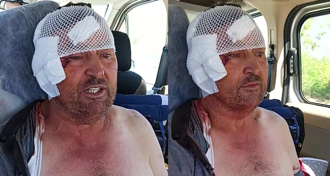Aslanın saldırısına uğrayan çiftçi o anları anlattı: 
