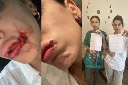 İstanbul'da kız kardeşler sokak ortasında dehşeti yaşadı: Önce darp sonra gasp edildiler